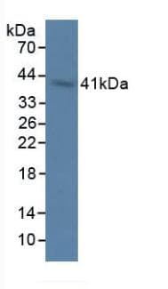 OAS1 Antibody (aa139-358)