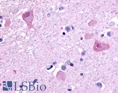 PathPlus™ Polyclonal Rabbit anti-Human GPR45 Antibody (C-Terminus, IHC)