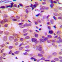 ATXN7L1 Antibody (Internal)