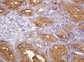 ATP6V1B2 Antibody (clone 1.00E+11, Carrier-free)