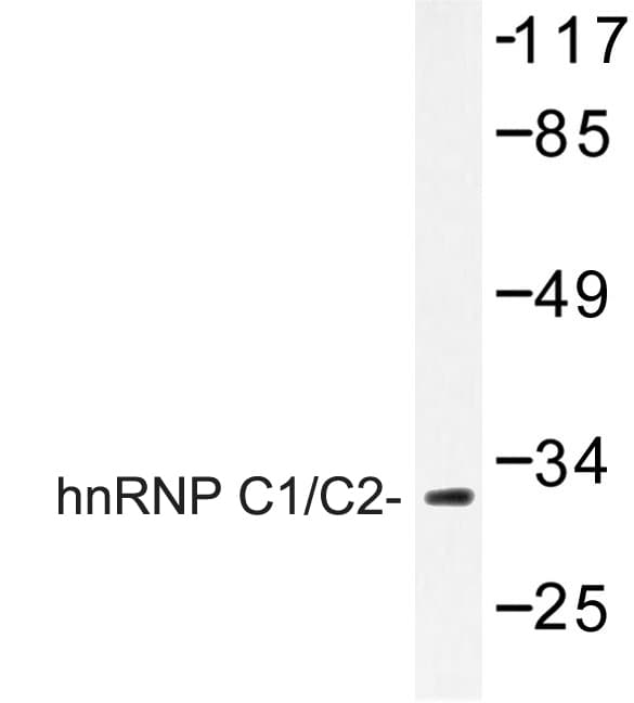 Polyclonal Rabbit anti-Human HNRNPC / HNRNP C Antibody (Asp271, IHC, IF, WB)