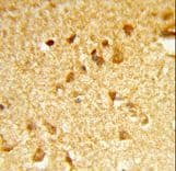 Polyclonal Rabbit anti-Human DDX17 Antibody (aa128-155, IHC, WB)