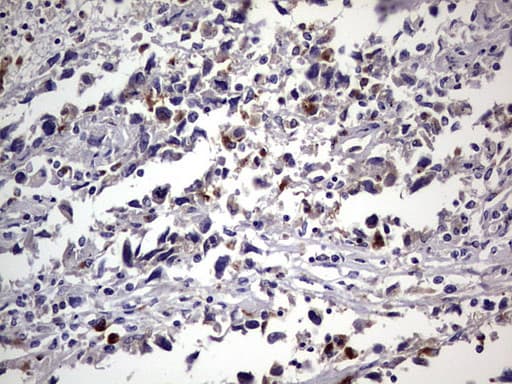 Monoclonal Mouse anti-Human CEACAM5 / CD66e Antibody (clone OTI3D8, aa35-680, IHC, WB)