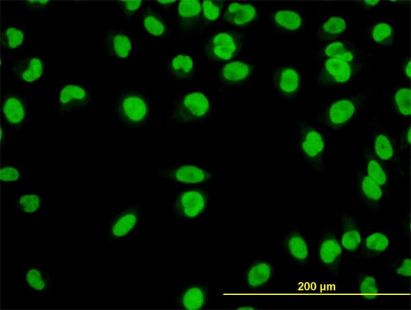 IHC-plus™ YY1 Antibody (clone 2C4)