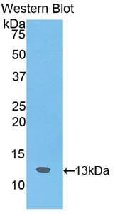 SLIT3 Antibody (aa62-119, FITC)
