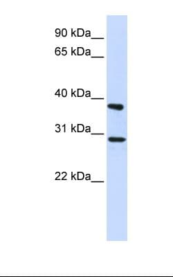 Polyclonal Rabbit anti-Human ING4 Antibody (aa110-159, IHC, WB)