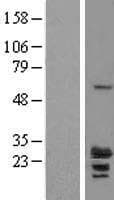 RILPL2 Protein (Over-Expression Lysate Myc-DDK (Flag))