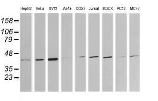 MAP2K1 / MKK1 / MEK1 Antibody (clone OTI1B4, Carrier-free)