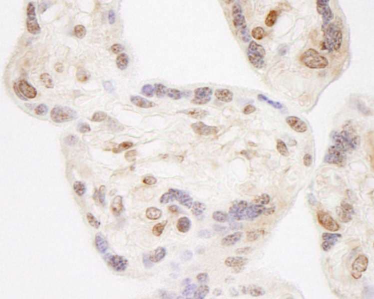Polyclonal Rabbit anti-Human NELFA / WHSC2 Antibody (aa499-549, IHC, WB)