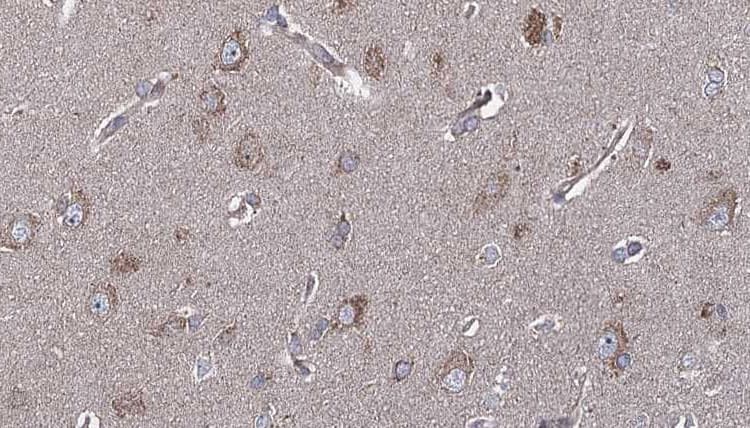 Polyclonal Rabbit anti-Human UCHL1 / PGP9.5 Antibody (IHC, IF, WB)