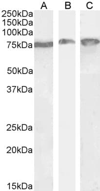 IHC-plus™ HSPA5 / GRP78 / BiP Antibody