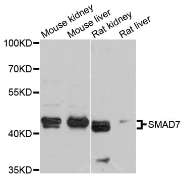 Polyclonal Rabbit anti-Human SMAD7 Antibody (IF, WB)