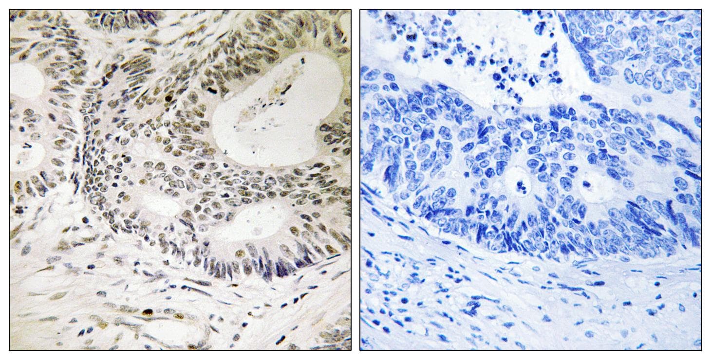Polyclonal Rabbit anti-Human TP53BP1 / 53BP1 Antibody (phospho-Ser25, IHC, IF)