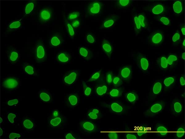 IHC-plus™ WDR20 Antibody (clone 2A6)
