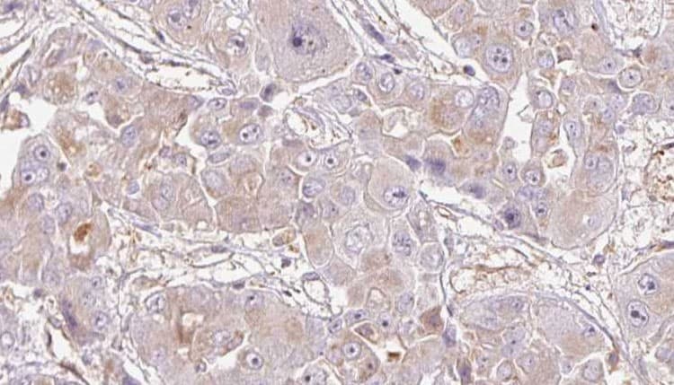 OR1K1 Antibody