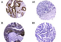 Polyclonal Rabbit anti-Human CARD8 / Cardinal / TUCAN Antibody (IHC, WB)