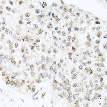 Polyclonal Rabbit anti-Human CETN3 Antibody (IHC, WB)