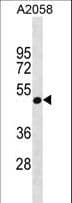 GNA11 Antibody (aa1-30)