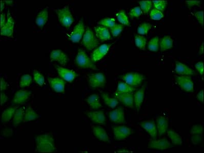 UPF3B Antibody