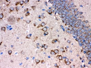 APBB1 / FE65 Antibody