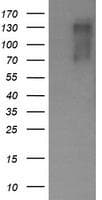 Monoclonal Mouse anti-Human ERBB2 / HER2 Antibody (clone OTI6H10, Carrier-free, aa676-1255, WB)