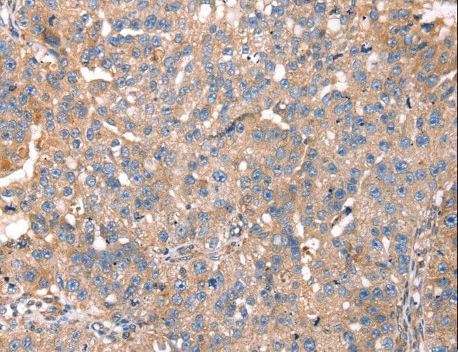 PDLIM4 / RIL Antibody