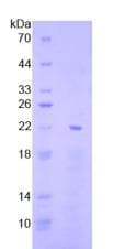Human ZIF268 / EGR1 Protein (Recombinant His, N-Terminal)