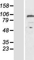 Carboxypeptidase Z / CPZ Protein (Over-Expression Lysate Myc-DDK (Flag))
