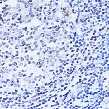 PARP1 Antibody