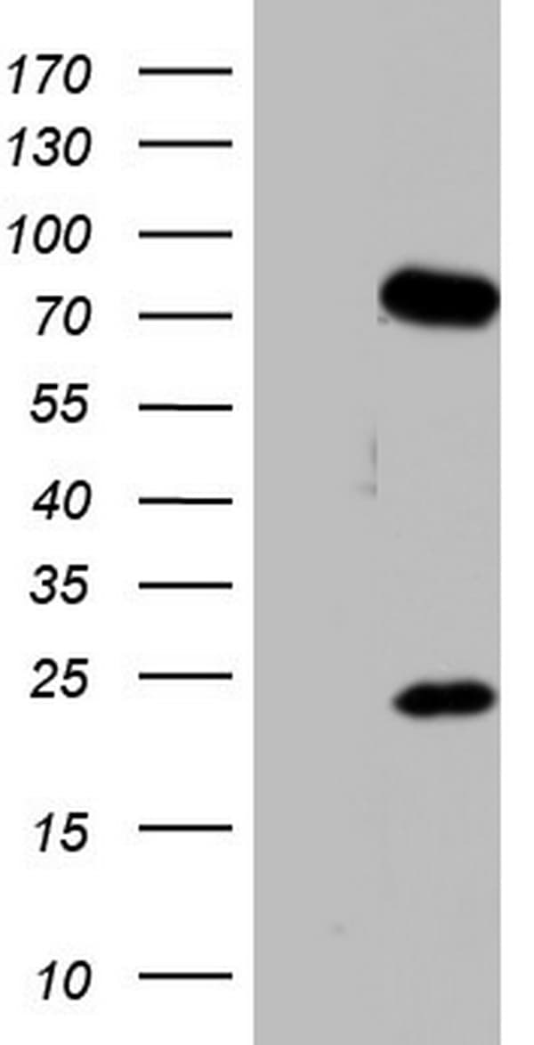 PPP2R5D Antibody (clone OTI6C12)