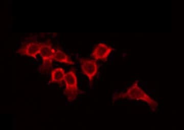 GRM4 / MGLUR4 Antibody
