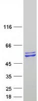 Human SARS2 / SYS Protein (Recombinant Myc-DDK (Flag))
