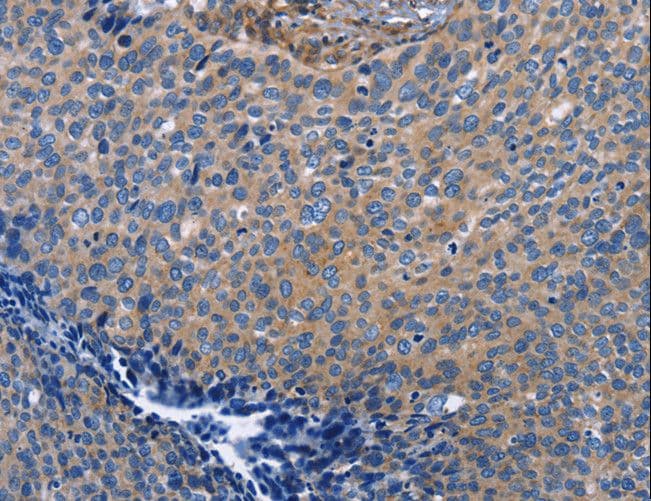 INTS10 Antibody