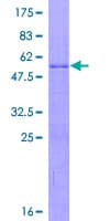 Human RPL15 / Ribosomal Protein L15 (Recombinant GST)