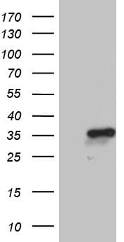 NABP1 / OBFC2A Antibody (clone OTI4D5)
