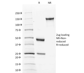 CANX / Calnexin Antibody (clone CANX/1543)