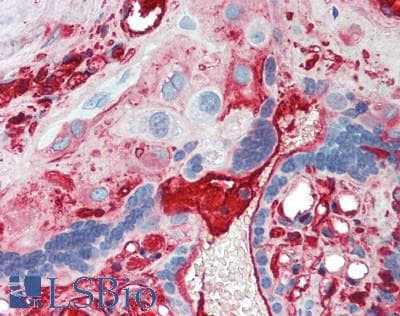 IgA1 Antibody