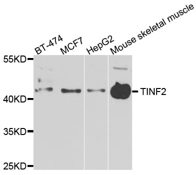 TINF2 Antibody