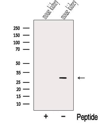 Polyclonal Rabbit anti-Human NIT2 Antibody (WB)