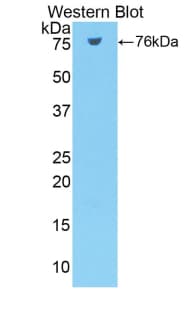 NRP1 / Neuropilin 1 Antibody (aa27-152)