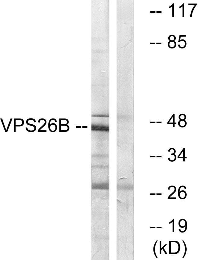 Polyclonal Rabbit anti-Human VPS26B Antibody (WB)