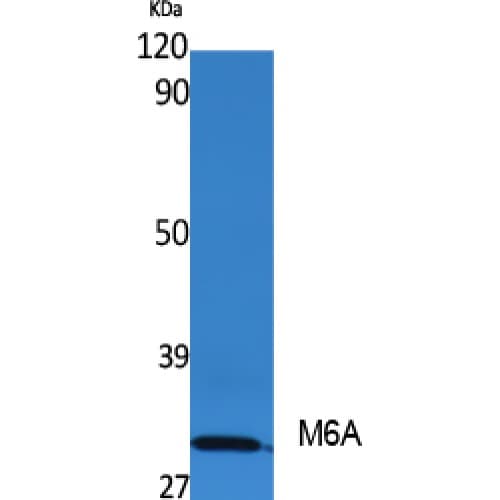 GPM6A / Glycoprotein M6A Antibody (140-220 aa, Internal)