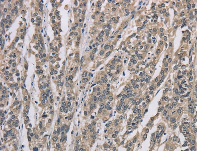 IHC-plus™ DSG2 / Desmoglein 2 Antibody