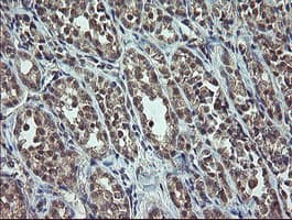 CDKN2B / p15 INK4b Antibody (clone OTI3B6)
