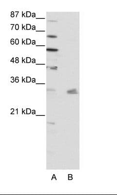 PITX3 Antibody (N-Terminus, HRP)