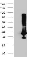 PNMT Antibody (clone OTI2F3)