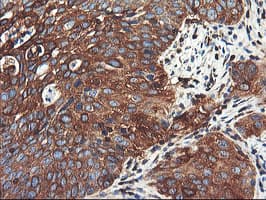 PFKP Antibody (clone OTI2E10)