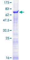 Human SEMA3D / Semaphorin 3D Protein (Recombinant GST)