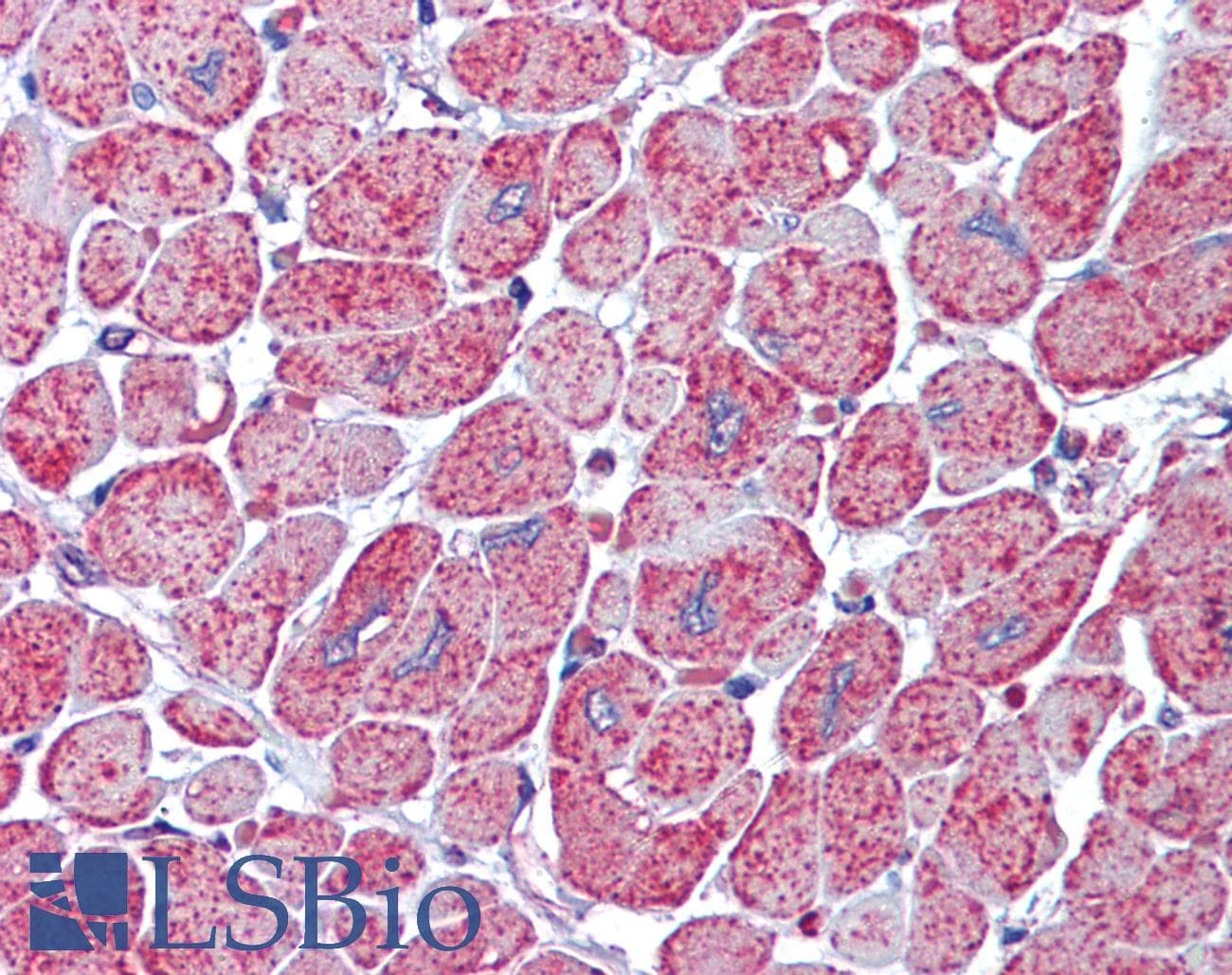 IHC-plus™ Polyclonal Rabbit anti-Human AKT1 + AKT2 Antibody (IHC, WB)
