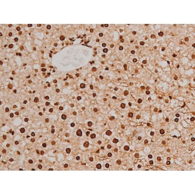Polyclonal Rabbit anti-Human EZR / Ezrin Antibody (phospho-Tyr353, IF, WB)